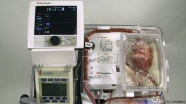 يوضع القلب في جهاز يسمى "قلب في صندوق" للحفاظ على نشاطه ونبضه لمدة ثلاث ساعات أخرى قبل إجراء الجراحة