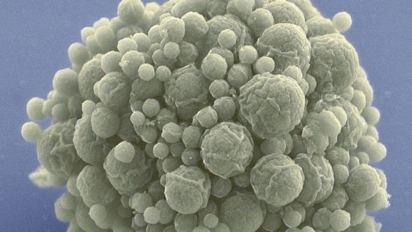 J. Craig Venter Institute "سينتيا" بكتيريا اصطناعية بأقصر شيفرة جينية في العالم 