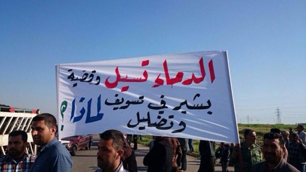 احدى المصابات في مستشفيات كركوك تتلقى العلاج بعد القصف الكيماوي لداعئ علىناحية تازة