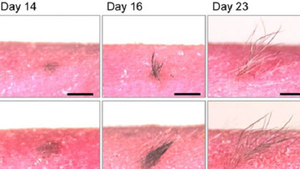 الباحثون وجدوا أن دورة الشعر الطبيعية تحدث في الجلد المزروع في الفئران 