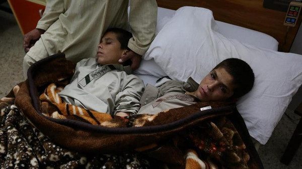الطفلان المريضان في باكستان 
