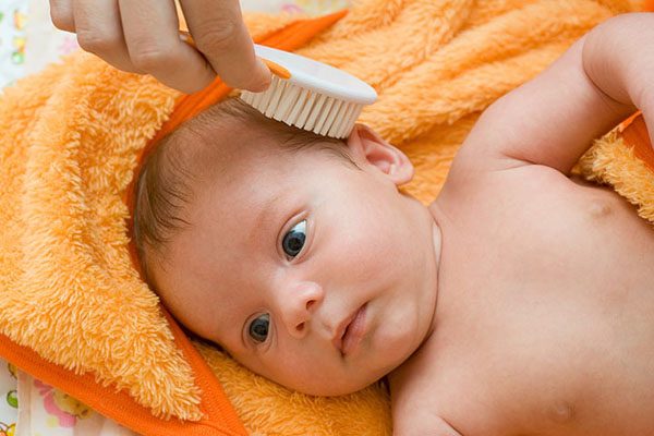 Dandruff-In-Babies