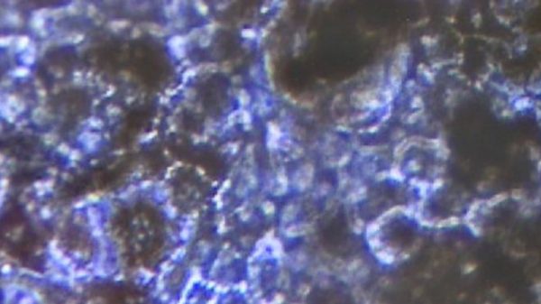 150929175723_stem_cell_cure_640x360_bbc_nocredit