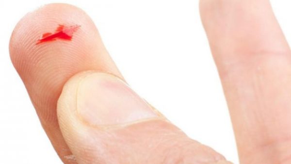 160908184055_why_paper_cuts_hurt_so_much_640x360_istock_nocredit