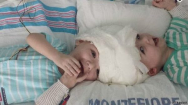 161014213527_twins_640x360_gofundme