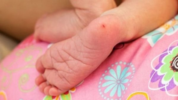 يجري الأطباء فحوصات للكشف عن فرط الكوليسترول بالدم من خلال أخذ عينة دم من كعب الطفل