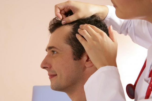 man-with-thinning-hair