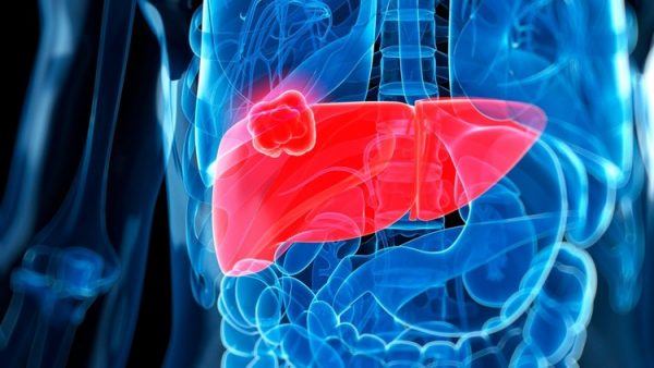 587f8cb4c461886d1c8b45a6