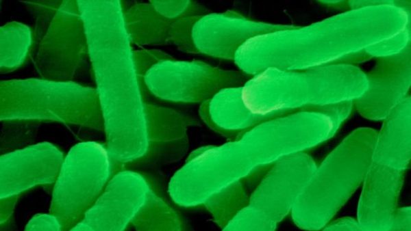 _93554047_c0322117-proteus_vulgaris_gram-negative_sem-spl