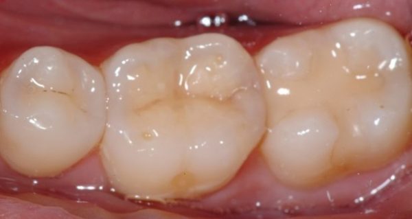 dailymedicalinfo-Endodontics3article (1)