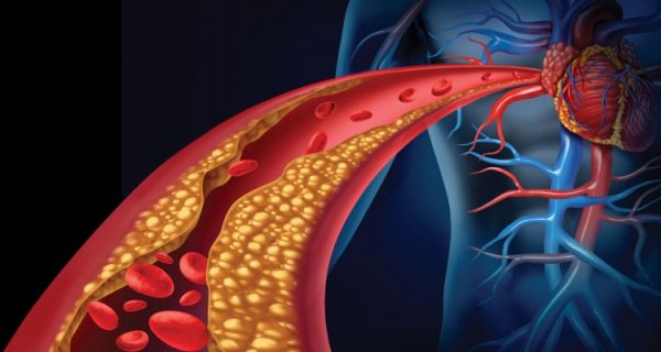 shutterstock_181632251-750x400